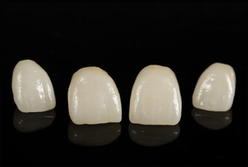 Porcelana CAD/CAM fundida com ponte de zircônio para restauração de aparência natural