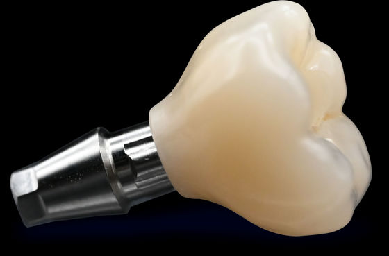 comprar CAD / CAM Implante Coroa Ponte Alta estética Coroa de zircônio online manufacture