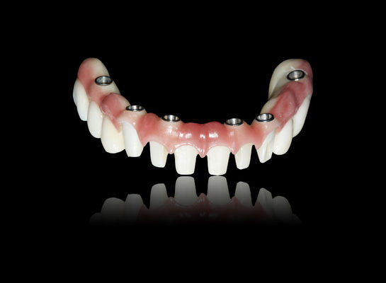 comprar Todos em X Implante Ponte Zirconia Implante Ponte Coroa Aparência natural online manufacture