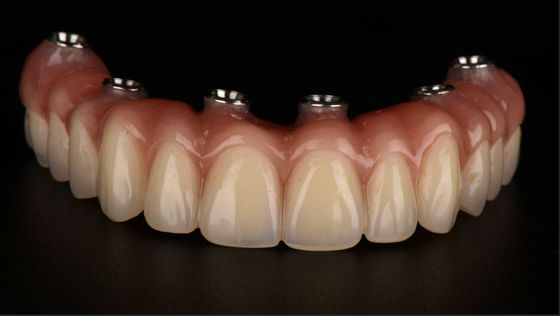comprar Todos em X Dentes dentárias com implante de Titânio Dental CE Approvada pela FDA online manufacture