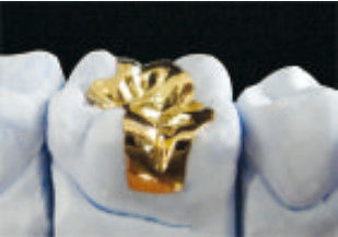 comprar Excelente encaixe Dental Gold Onlay Inlays e Onlays de ouro CE e FDA online manufacture