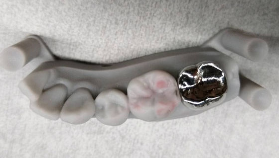 comprar Implante de coroa de metal não precioso PFM Crown And Bridge Professional online manufacture