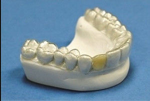 comprar Dentário Dentes Estabilizados Retentor Ortodôntico Retentor Profissional online manufacture