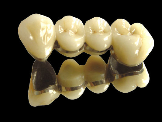 comprar Implante de ponte de metal precioso ponte de coroa resistente ao desgaste personalizado online manufacture