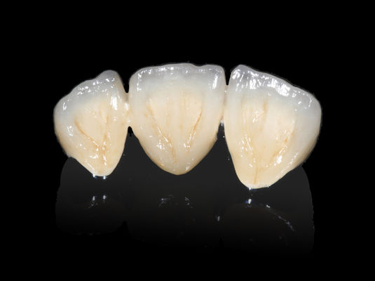 comprar Implante Dental PFM Ponte Não Precioso CAD CAM PFM Coroa online manufacture