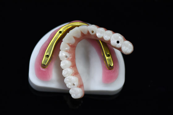 comprar Ponte de zircônio dental personalizável sobre barra de implante moída Alta precisão online manufacture