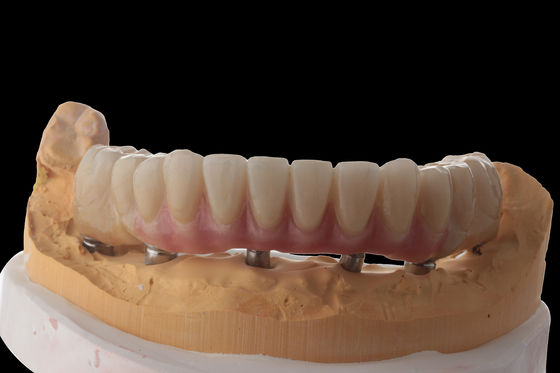 comprar Personalizar implantes dentários híbridos Dentadura híbrida com barra de titânio online manufacture
