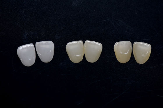 comprar Veneers de zircônio de alta estética de longa duração online manufacture