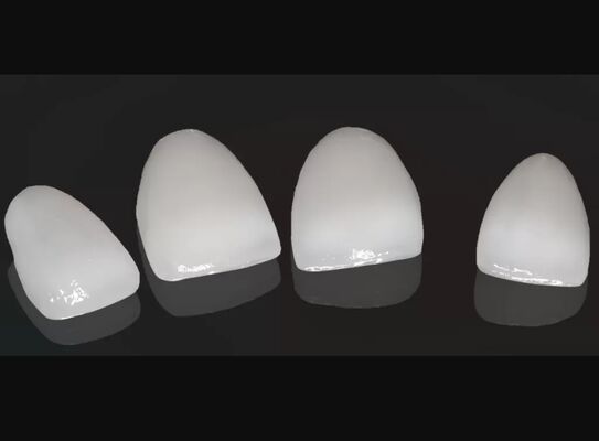 comprar Alta estética coroa composta onlay veneer tamanho personalizável online manufacture