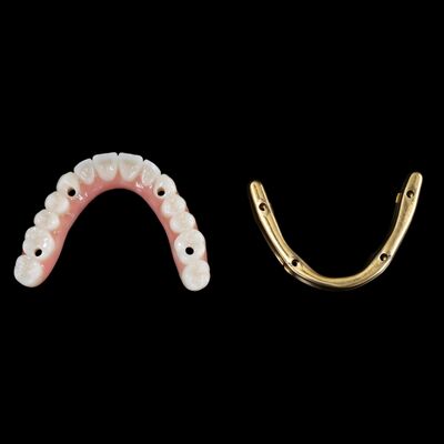 comprar Personalizar implantes dentários híbridos Dentadura híbrida com barra de titânio online manufacture