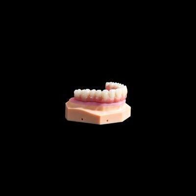 comprar Implante dentário de ponte de titânio com compósito preciso online manufacture