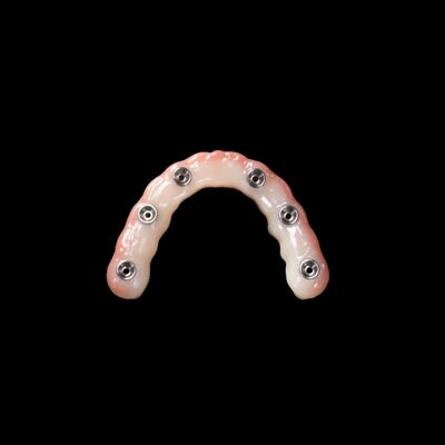comprar Implantação de dentaduras de carga imediata Dentes artificiais removíveis cor-de-rosa clara online manufacture