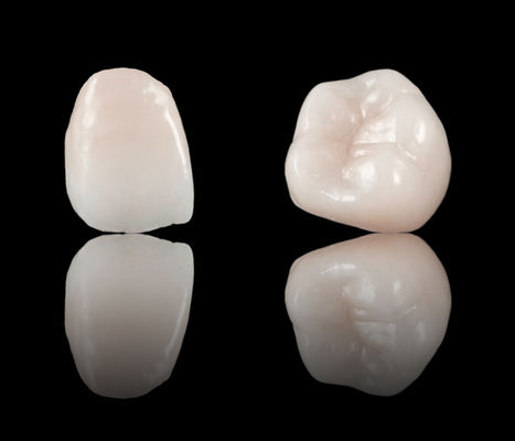Alta estética de contorno completo da coroa dental de zircônio ponte CE e aprovação da FDA