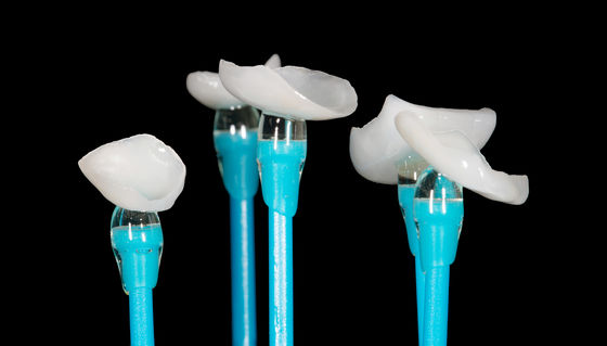 EMAX Prensado Onlay Veneer Alta Precisão Veneer Dental Excelente Ajuste