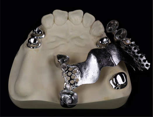 Telescópio Coroa e Ponte Metálicos para Odontologia e Ortodontia