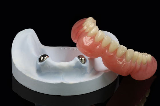 Dentaduras removíveis por telescópio Aplicação de precisão Dentaduras excessivas Arylic