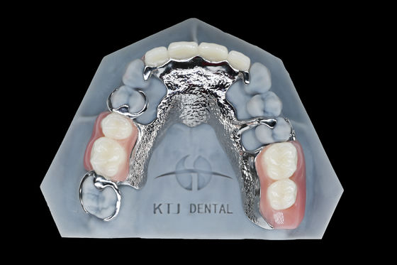 Quadro de Titânio Metal Dentadura Dentes Falso Removível Personalizado