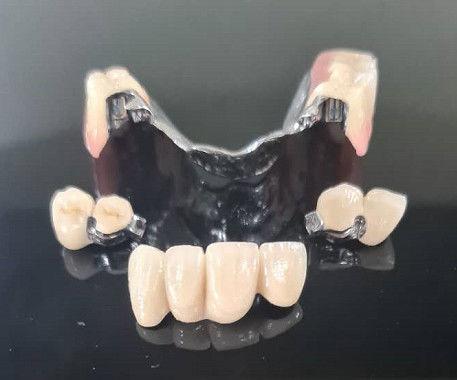 Quadro metálico Aplicação de precisão Dentadura extraível Dentadura removível