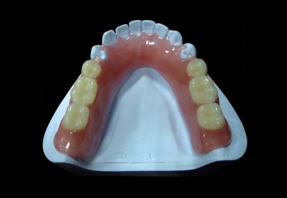 Dentadura parcial acrílica removível rosa Dentadura parcial acrílica temporária