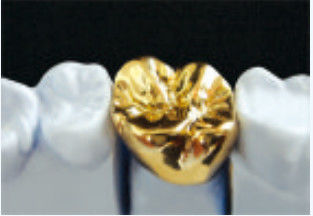 Coroa de metal amarelo e ponte Coroa de liga preciosa ponte personalizável
