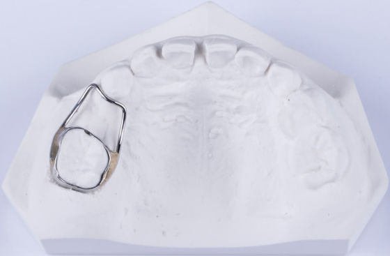 Retentor de espaço dental personalizável para retentor de dentes para corrigir o espaço