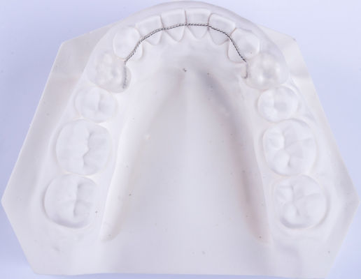 Retentor de fio de língua não removível Retentores de ortodontia para endireitar os dentes