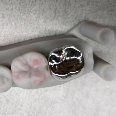 Coroa de metal completo e ponte de alta precisão Coroa temporária de prata