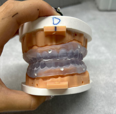 Dentes dentários impressos em 3D personalizáveis Tente em Dentadura Digital Completa