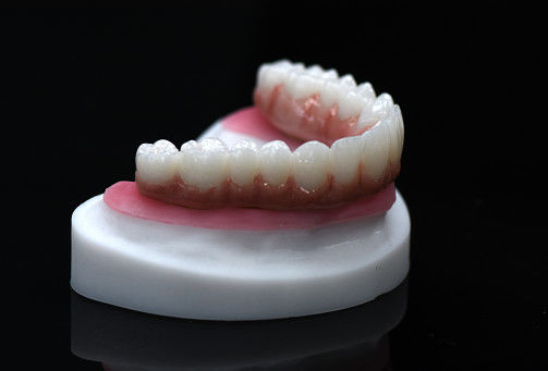 Full Arch Zirconia Hybrid Bridge Zirconia Crown Bridge Personalizado