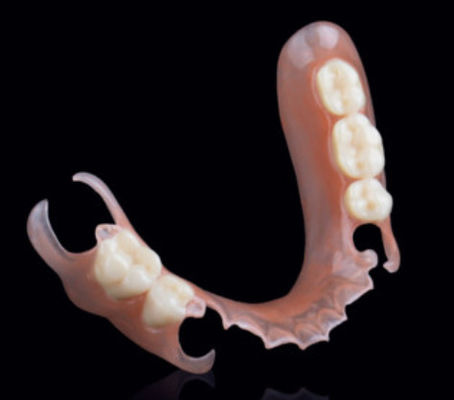 Valplast Flexíveis Dentes Parciais Removíveis Aplicação de Precisão Em Prótese