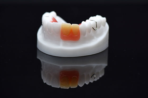 Dentadura extraível de nadadeira de acrílico Dentadura extraível de acrílico personalizada