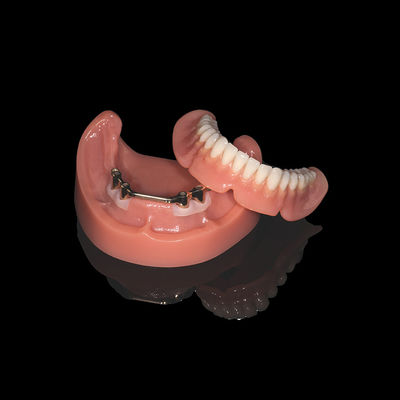Dentes removíveis de barra de titânio rosa com acabamento de dentadura acrílica
