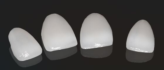 Alta estética coroa composta onlay veneer tamanho personalizável