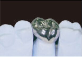 Coroa de metal completo e ponte de alta precisão Coroa temporária de prata